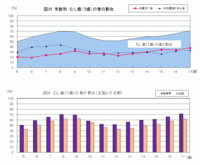 むし歯（う歯）