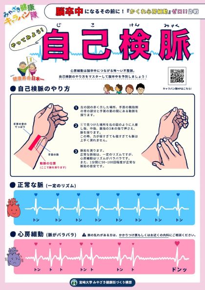 自己検脈